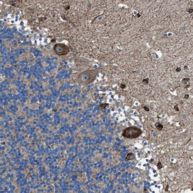 TMEM126B Antibody in Immunohistochemistry (IHC)