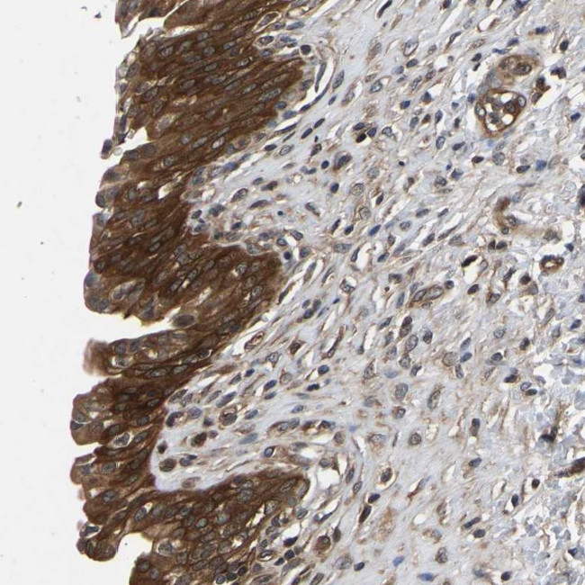 FGD5 Antibody in Immunohistochemistry (Paraffin) (IHC (P))