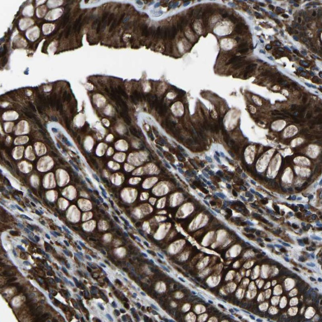 SCAMP2 Antibody in Immunohistochemistry (Paraffin) (IHC (P))