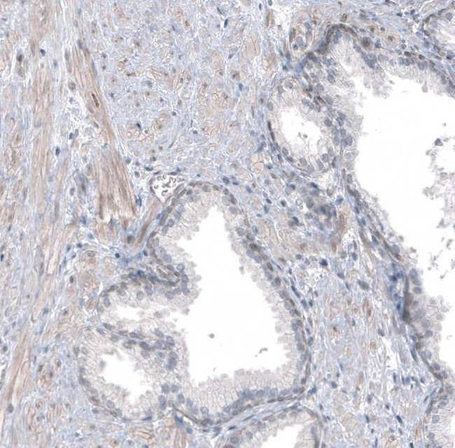 TMEM43 Antibody in Immunohistochemistry (IHC)