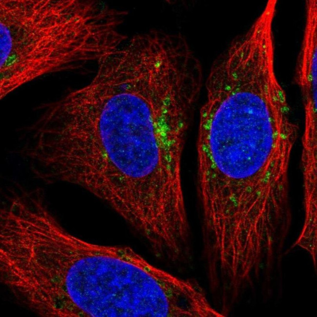 STARD3NL Antibody in Immunocytochemistry (ICC/IF)