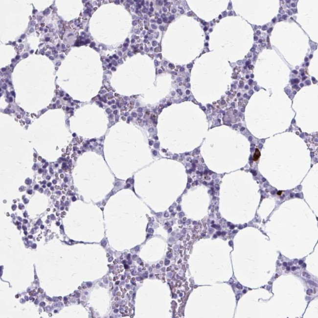 ZDHHC7 Antibody in Immunohistochemistry (Paraffin) (IHC (P))