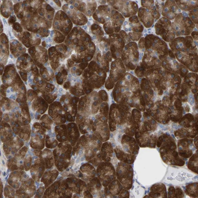 UBE4B Antibody in Immunohistochemistry (Paraffin) (IHC (P))