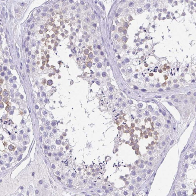 SPATA4 Antibody in Immunohistochemistry (Paraffin) (IHC (P))