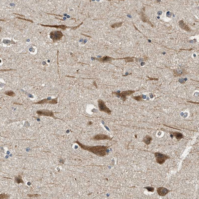 YAE1D1 Antibody in Immunohistochemistry (Paraffin) (IHC (P))
