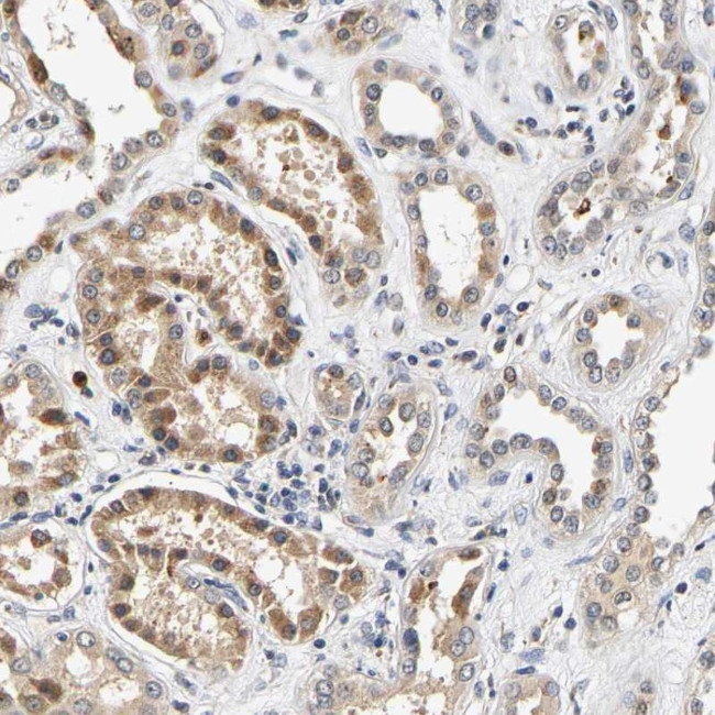 SMU1 Antibody in Immunohistochemistry (Paraffin) (IHC (P))