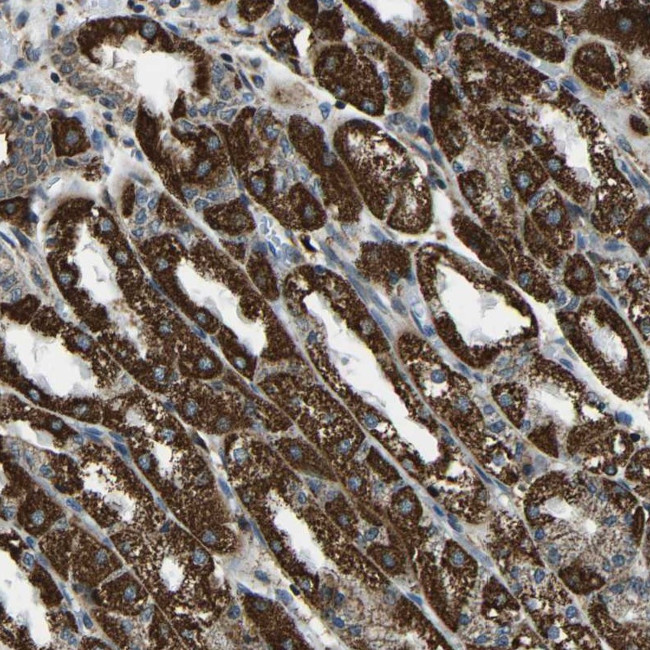 RBM33 Antibody in Immunohistochemistry (Paraffin) (IHC (P))