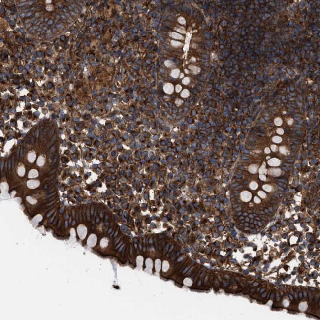 EPS15R Antibody in Immunohistochemistry (Paraffin) (IHC (P))