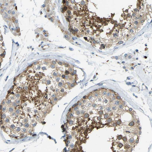 TXNDC3 Antibody in Immunohistochemistry (Paraffin) (IHC (P))