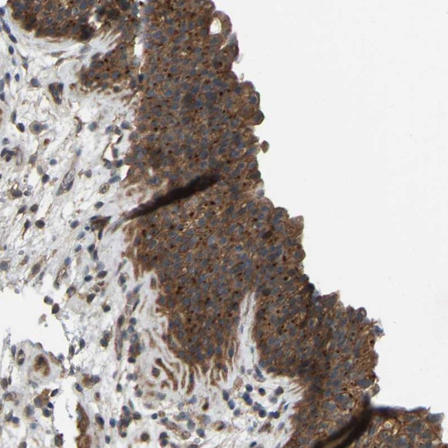 WDR53 Antibody in Immunohistochemistry (Paraffin) (IHC (P))