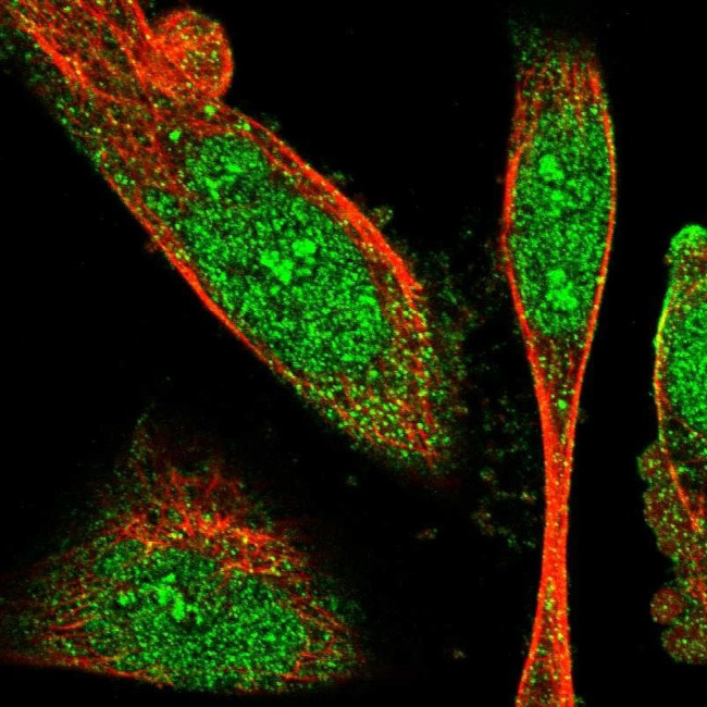 SNX30 Antibody in Immunocytochemistry (ICC/IF)