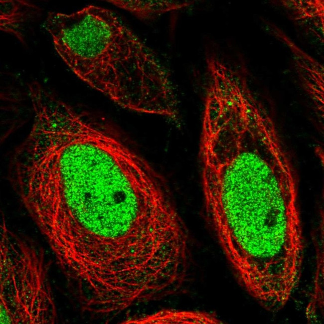 LRRC61 Antibody in Immunocytochemistry (ICC/IF)