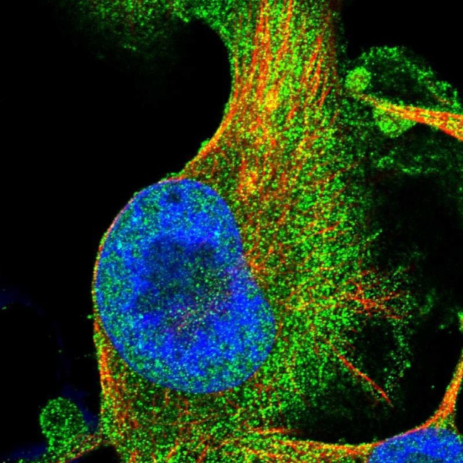 ANKIB1 Antibody in Immunocytochemistry (ICC/IF)