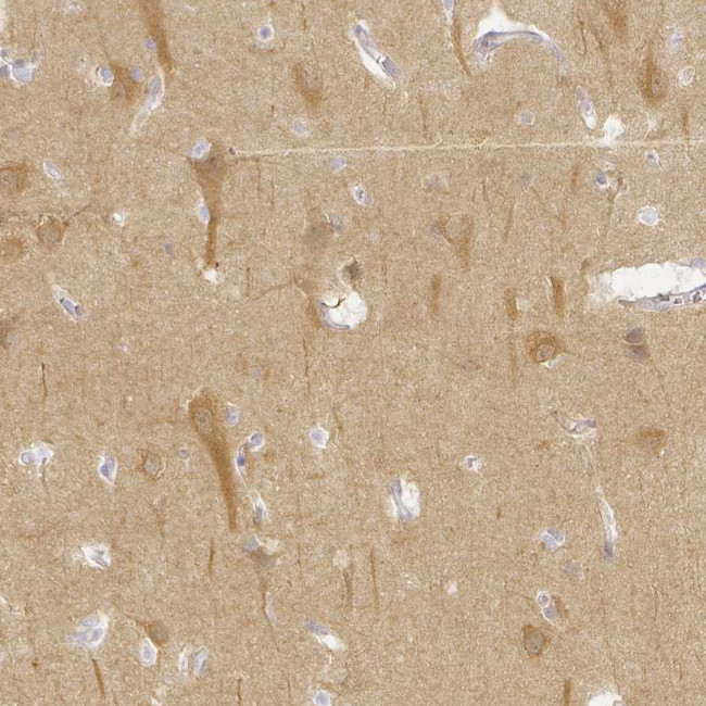 KCNH1 Antibody in Immunohistochemistry (Paraffin) (IHC (P))