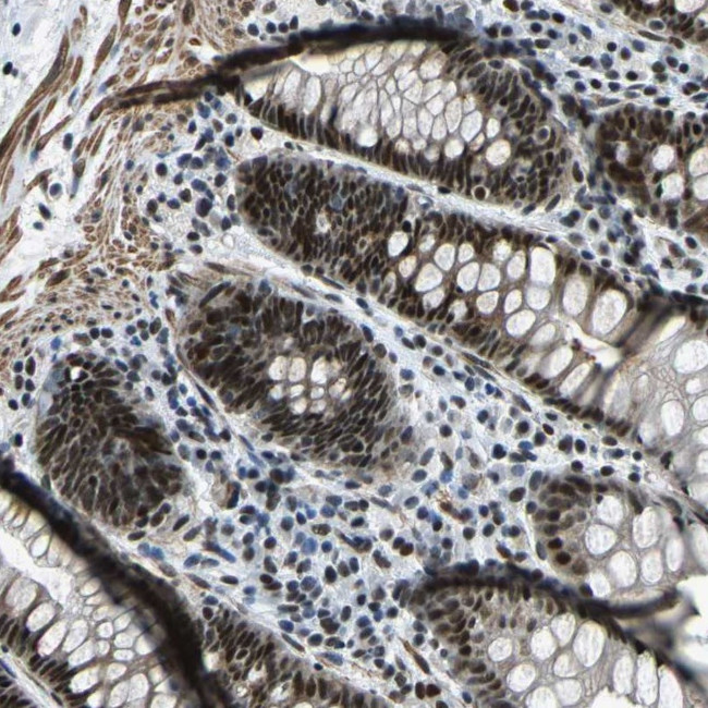 PRCC Antibody in Immunohistochemistry (Paraffin) (IHC (P))