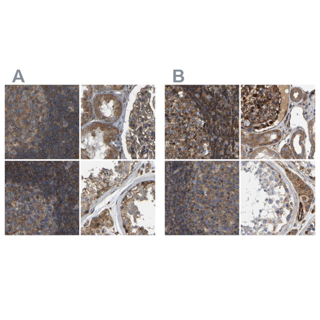 SAMD9L Antibody in Immunohistochemistry (IHC)