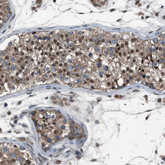 ZFAND2A Antibody in Immunohistochemistry (Paraffin) (IHC (P))