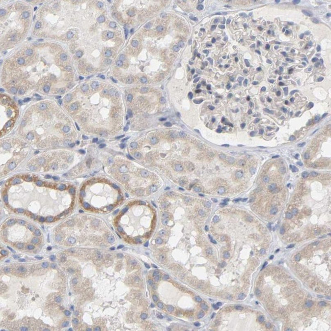 FAM188B Antibody in Immunohistochemistry (IHC)
