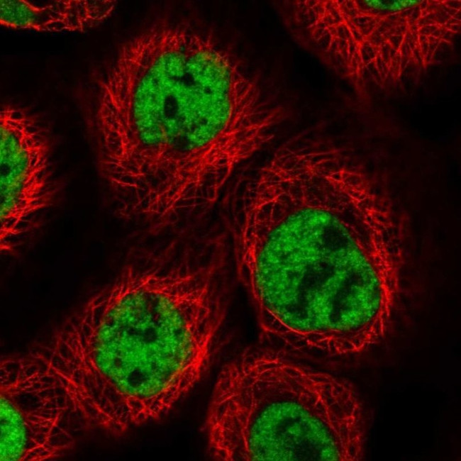 PRCC Antibody in Immunocytochemistry (ICC/IF)