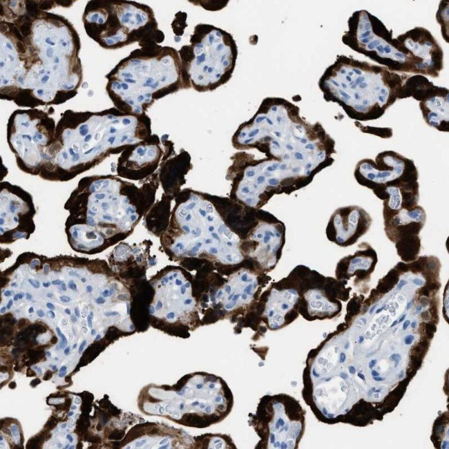 S100P Antibody in Immunohistochemistry (IHC)