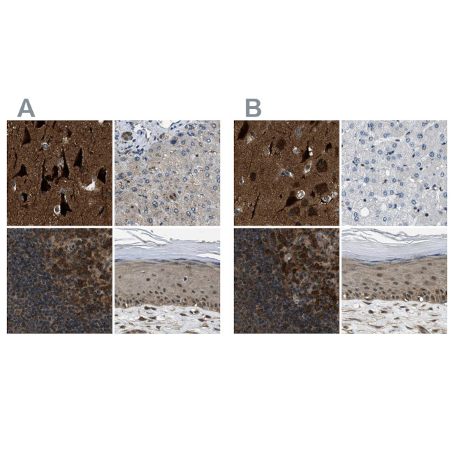NUDCD3 Antibody in Immunohistochemistry (IHC)
