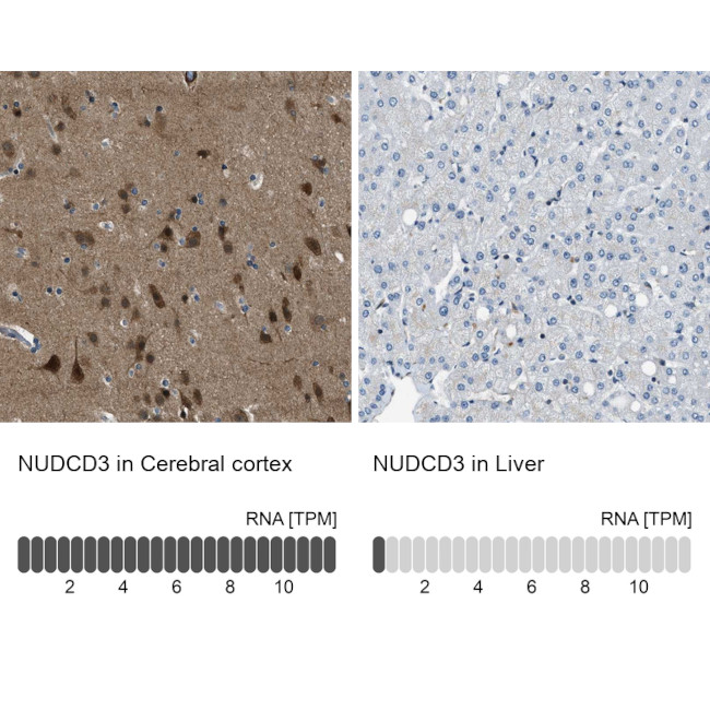 NUDCD3 Antibody in Immunohistochemistry (IHC)