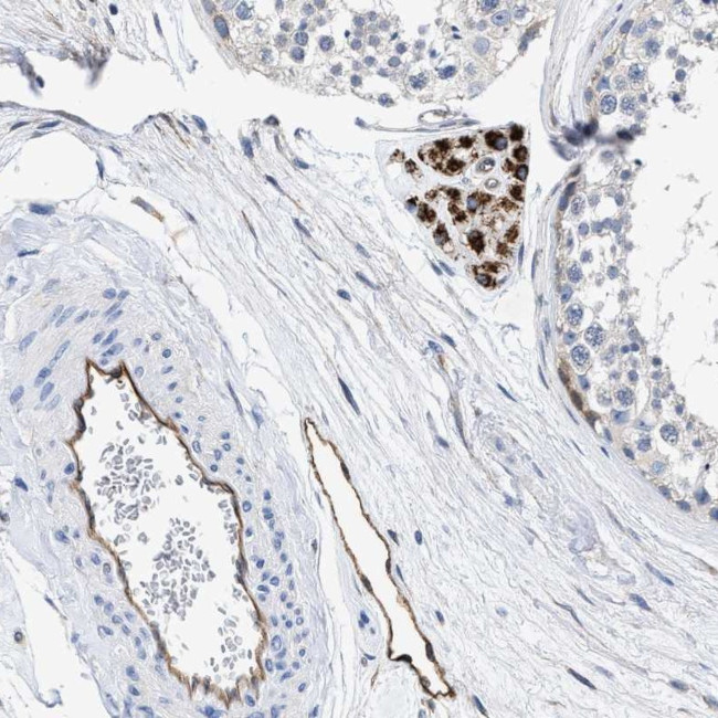 C22orf42 Antibody in Immunohistochemistry (Paraffin) (IHC (P))