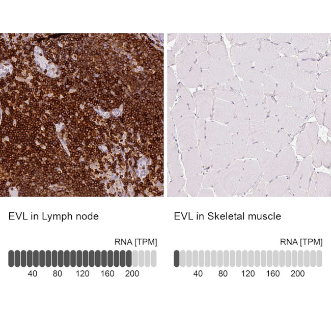 EVL Antibody