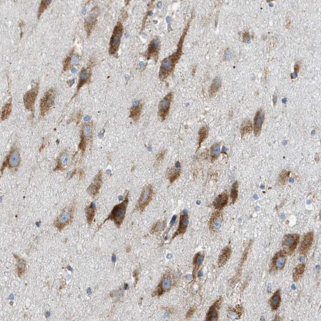 LMBRD1 Antibody in Immunohistochemistry (Paraffin) (IHC (P))