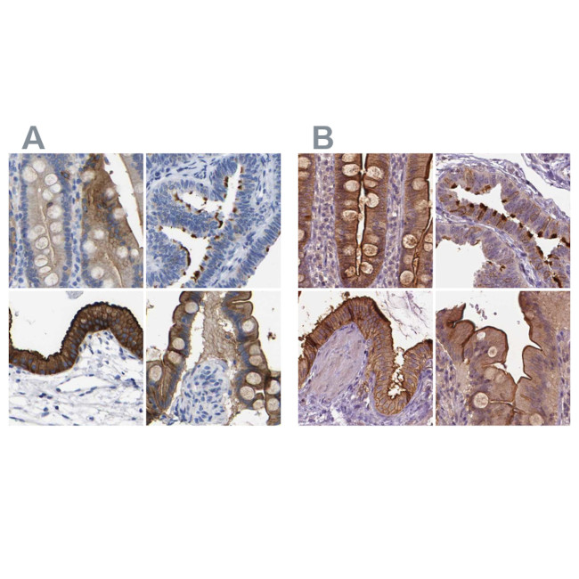 Annexin A13 Antibody in Immunohistochemistry (IHC)