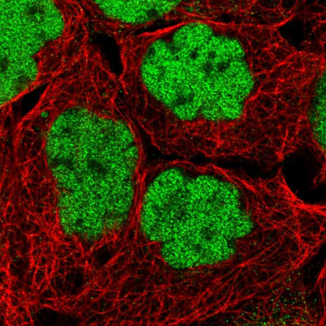 MIER1 Antibody in Immunocytochemistry (ICC/IF)
