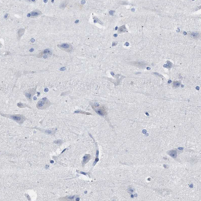 HEMGN Antibody in Immunohistochemistry (Paraffin) (IHC (P))