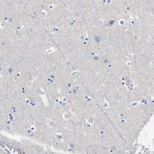 HEMGN Antibody in Immunohistochemistry (Paraffin) (IHC (P))