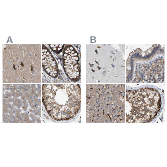 GCN1L1 Antibody in Immunohistochemistry (IHC)