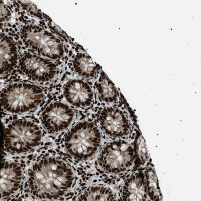 GABPB1 Antibody in Immunohistochemistry (Paraffin) (IHC (P))