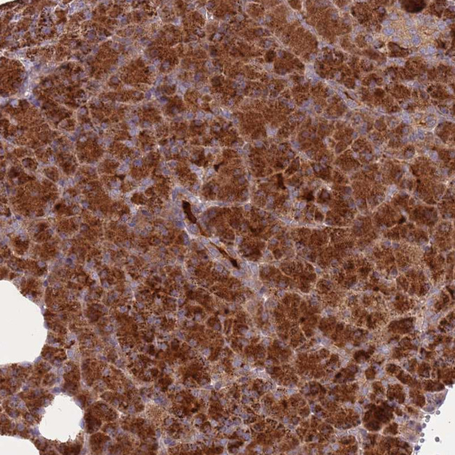 RNF128 Antibody in Immunohistochemistry (Paraffin) (IHC (P))