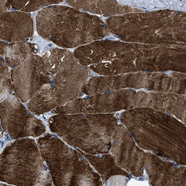 MURF3 Antibody in Immunohistochemistry (Paraffin) (IHC (P))