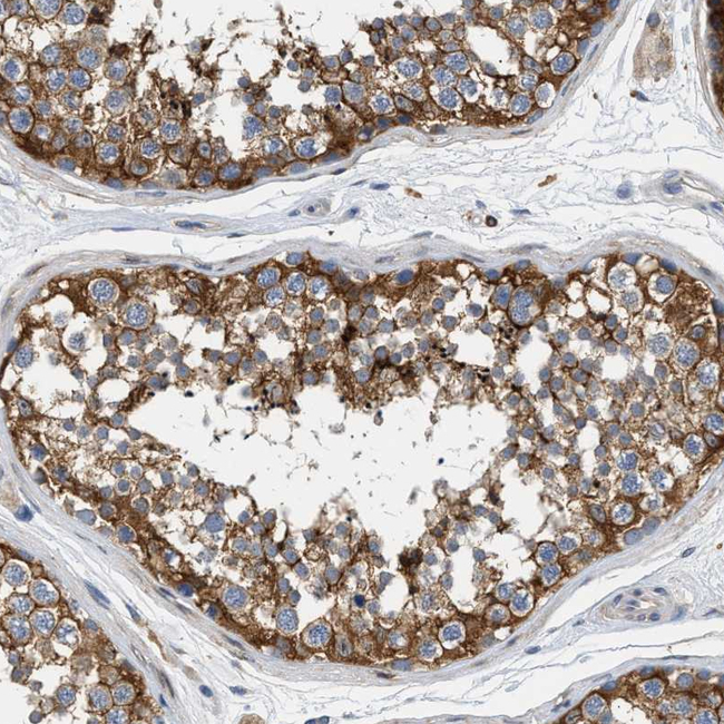 RAB31 Antibody in Immunohistochemistry (Paraffin) (IHC (P))