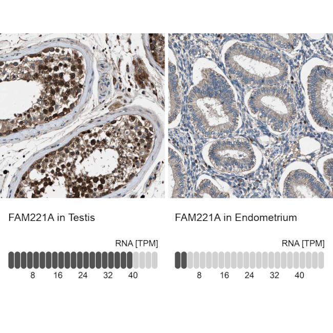 FAM221A Antibody in Immunohistochemistry (IHC)