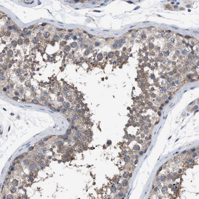 DDX56 Antibody in Immunohistochemistry (Paraffin) (IHC (P))