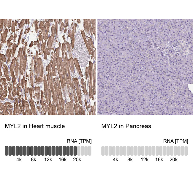 MYL2 Antibody in Immunohistochemistry (Paraffin) (IHC (P))