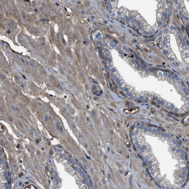 Tara Antibody in Immunohistochemistry (Paraffin) (IHC (P))