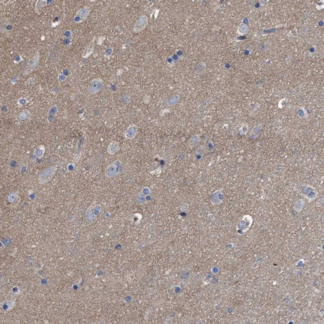 FAM171A2 Antibody in Immunohistochemistry (Paraffin) (IHC (P))