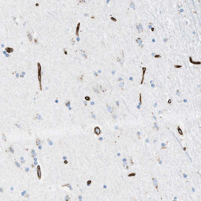 SLC22A15 Antibody in Immunohistochemistry (Paraffin) (IHC (P))