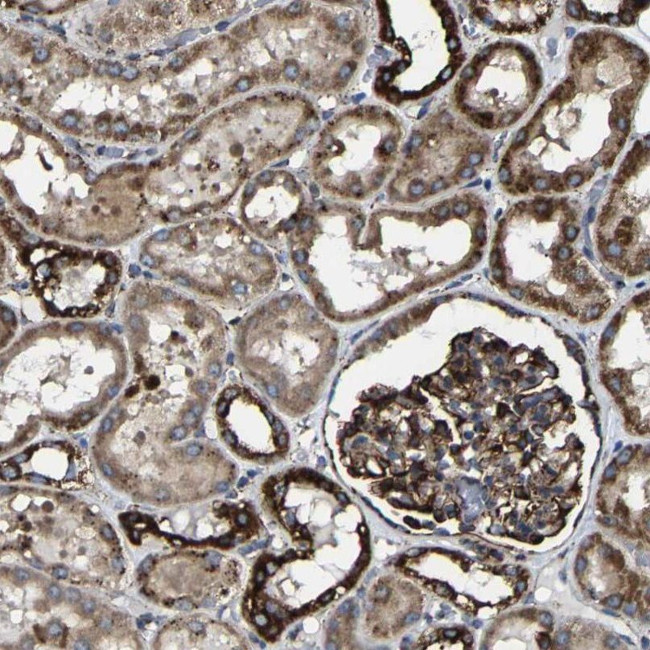 NDUFV3 Antibody in Immunohistochemistry (IHC)
