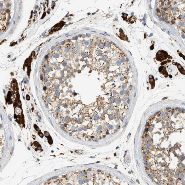 ENTHD1 Antibody in Immunohistochemistry (Paraffin) (IHC (P))