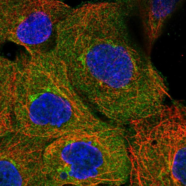 UBAP1 Antibody in Immunocytochemistry (ICC/IF)