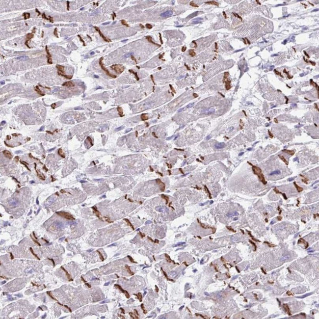 FTSJ2 Antibody in Immunohistochemistry (IHC)