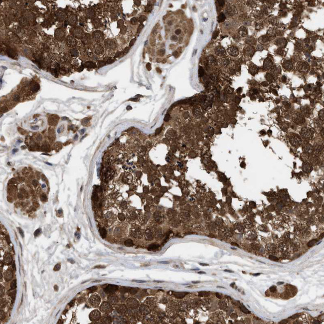 FITM1 Antibody in Immunohistochemistry (Paraffin) (IHC (P))