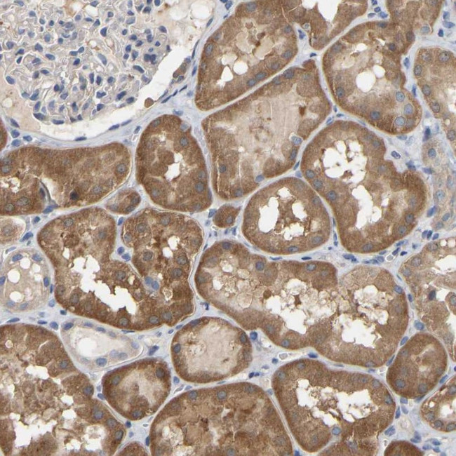SSH1 Antibody in Immunohistochemistry (Paraffin) (IHC (P))